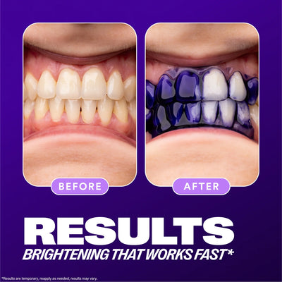 Hismile Teeth Brightening Serum V34