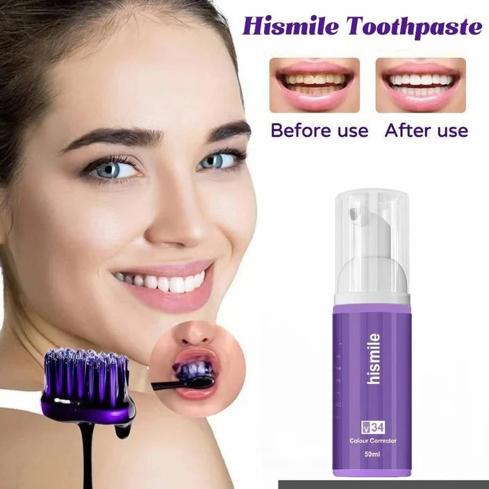 Hismile Teeth Brightening Serum V34